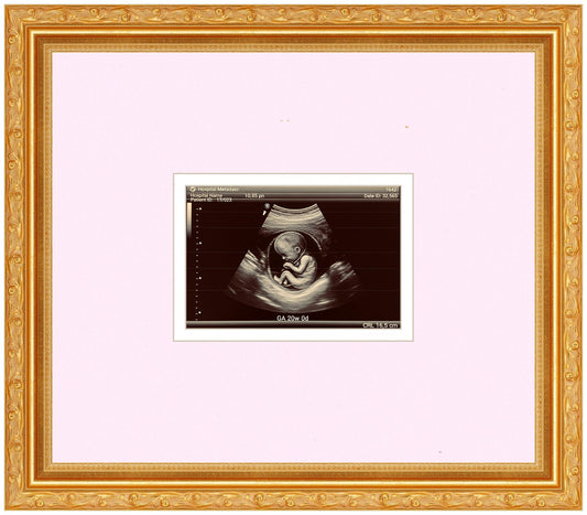 Ultrasound Sonogram Frame (Style 1)