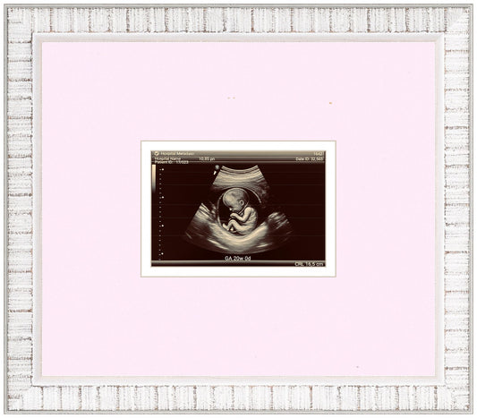 Ultrasound Sonogram Frame (Style 2)