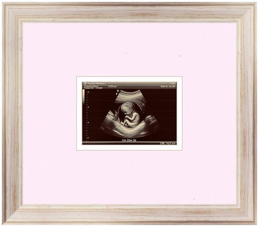 Ultrasound Sonogram Frame (Style 3)