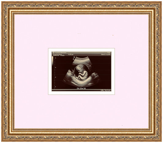 Ultrasound Sonogram Frame (Style 4)