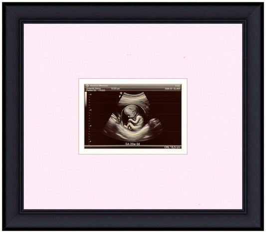 Ultrasound Sonogram Frame (Style 5)