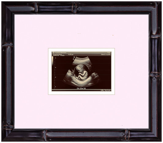 Ultrasound Sonogram Frame (Style 6)
