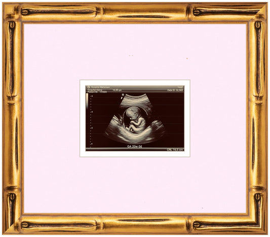 Ultrasound Sonogram Frame (Style 7)