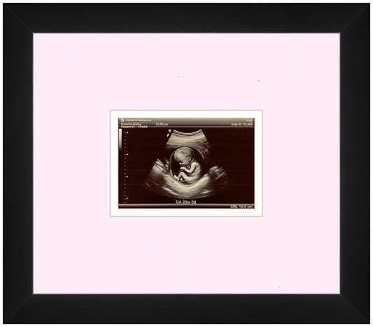 Ultrasound Sonogram Frame (Style 8)