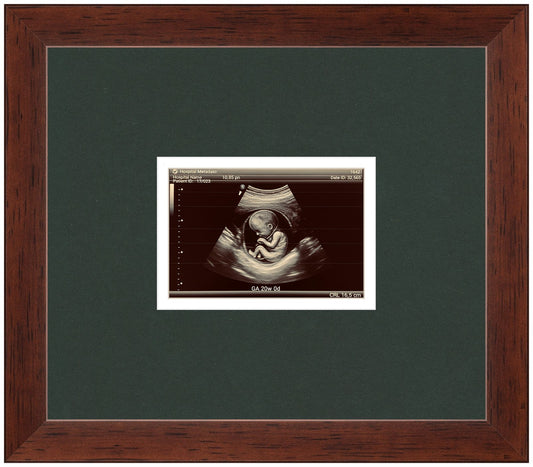 Ultrasound Sonogram Frame (Style 9)