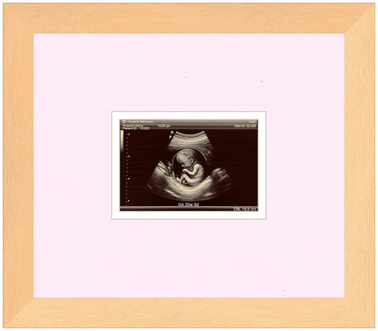 Ultrasound Sonogram Frame (Style 10)