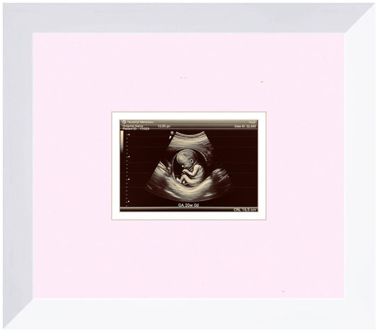 Ultrasound Sonogram Frame (Style 11)