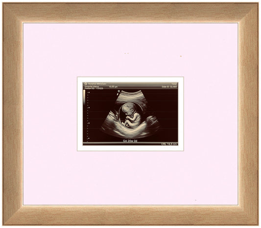 Ultrasound Sonogram Frame (Style 12)