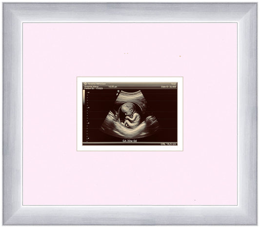 Ultrasound Sonogram Frame (Style 13)